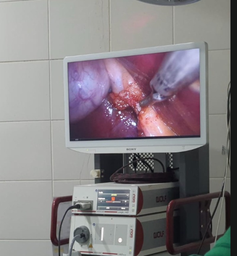 Robotic-Assisted